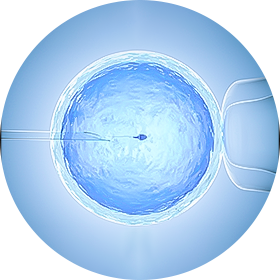 Fertilização In Vitro